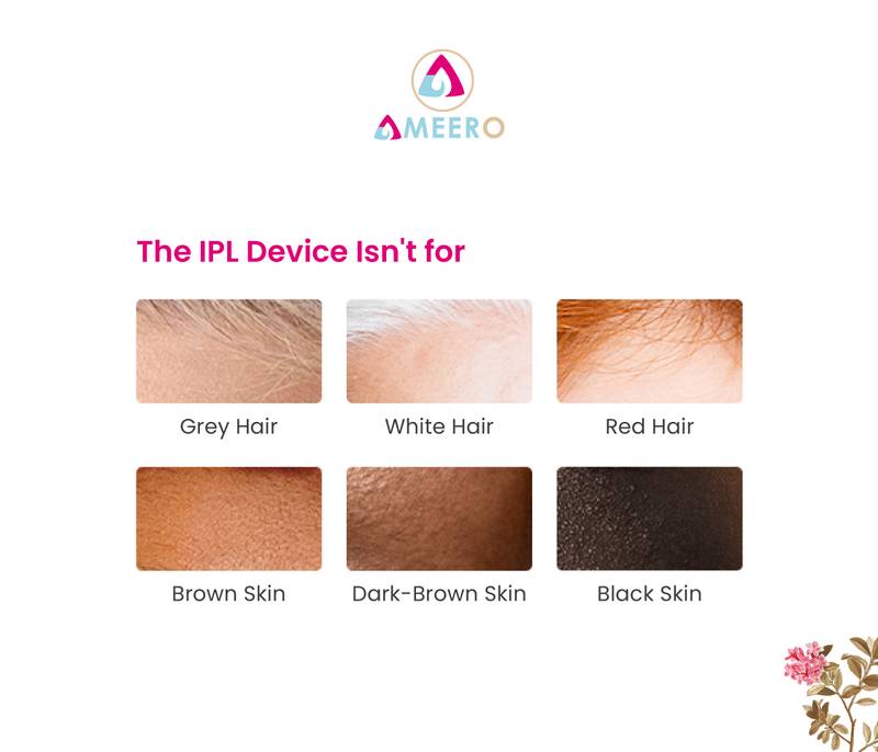 Ameero IPL Laser Hair Removal – Ditch the Razor, Keep the Smooth - Image 6